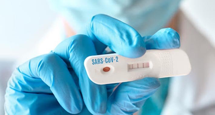DW: PCR biznis u RS-u, Institut od komercijalnog testiranja zaradio 7,9 miliona KM