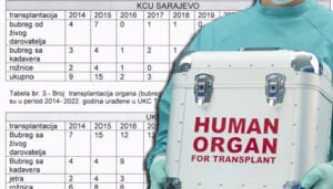 U Federaciji BiH prošle godine obavljeno samo sedam transplantacija