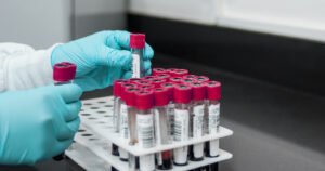 Hrvatska treća u Evropi dobija laboratoriju za gensko profiliranje tumora