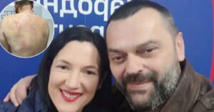 Pretučen član stranke Jelene Trivić: “Pretukla su me dva vojnika SNSD-a”