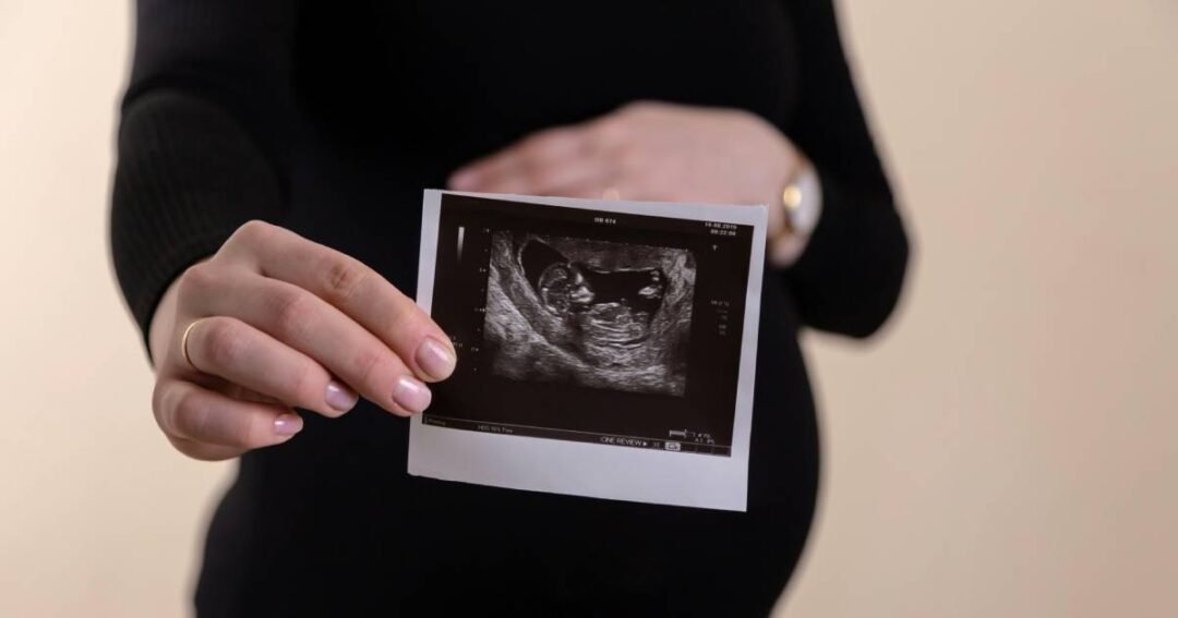 trudnoca trudnica ultrazvuk