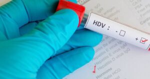 Hepatitis D često ostaje neotkriven, uprkos mogućnostima liječenja